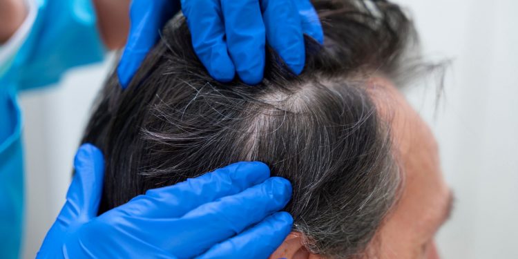 How to find the mens hair system 2023 bestsellers