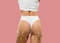 Achieve Your Dream Curves: Everything You Need to Know About Sculptra Butt Lift in London