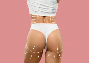Achieve Your Dream Curves: Everything You Need to Know About Sculptra Butt Lift in London