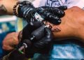 Can a Tattoo Be Removed Completely?