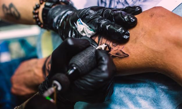 Can a Tattoo Be Removed Completely?